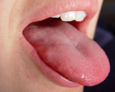 Язик, зображення з вільних джерел