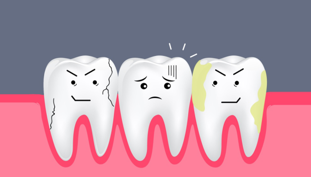Не игнорируй кариес: как дырка в зубе может привести к быстрой смерти