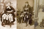 Чотиринога жінка "зламала мозок" сотням людей: ненароджений сіамський близнюк чи дивний набір органів