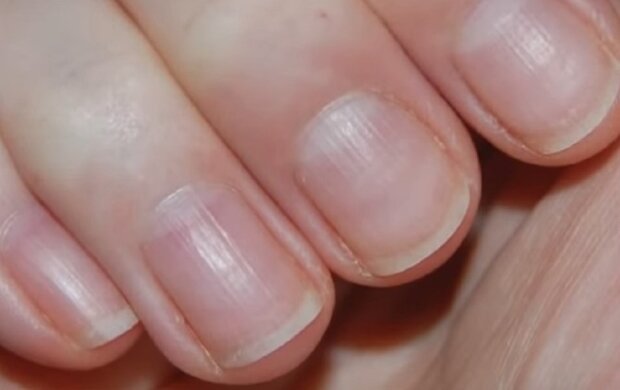 Здорові нігті. Фото: YouTube