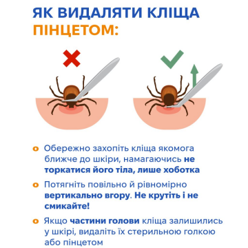 Как удалить клеща. Фото: Центр общественного здоровья