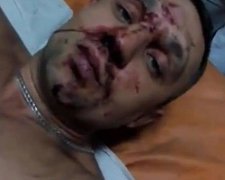 Невідомі всадили 12 куль в ветерана АТО