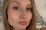 Дівчина з невдалими "уколами краси", фото із соцмереж