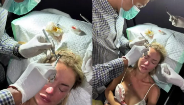 Казахстанская модель отправила россиянку в больницу