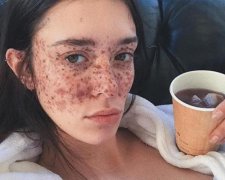 Модель с невероятными веснушками покорила Instagram