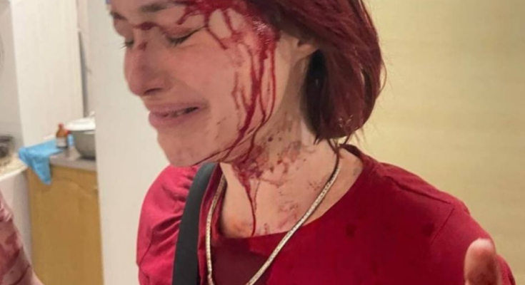 Девушка, избитая работником ТЦК. Фото: "Думская"