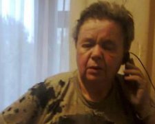 Кандидатке в ровенские депутаты брызнули кислотой в лицо (фото)