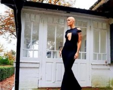 Облысение - не приговор! Девушка доказала это удивительными снимками 