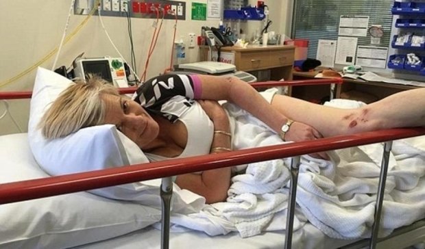 Після нападу кенгуру австралійка збільшила груди