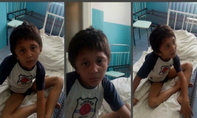 Не говорить і не ходить: у Кременчуці знайшли дитину-мауглі