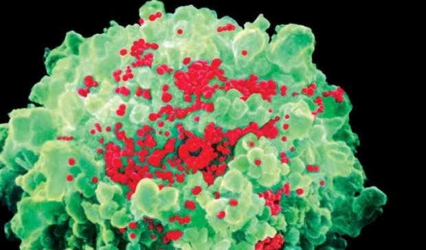 Нова вакцина від ВІЛ допомогла першим пацієнтам