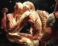 Десятки трупов на ВДНХ: почему скандальную выставку Body Worlds передумали увозить из Киева