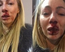 Після звільнення москвичку жорстоко побили (фото)