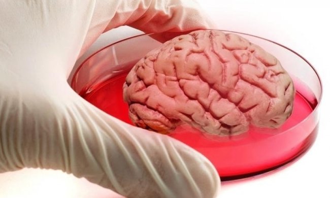 Людський мозок вперше виростили в лабораторії