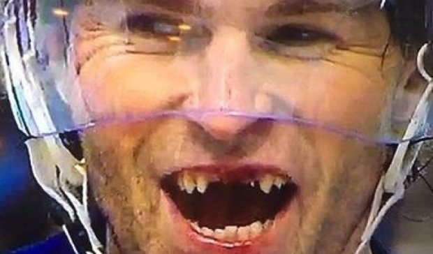 Знаменитый хоккеист попросил у Санта-Клауса новые зубы