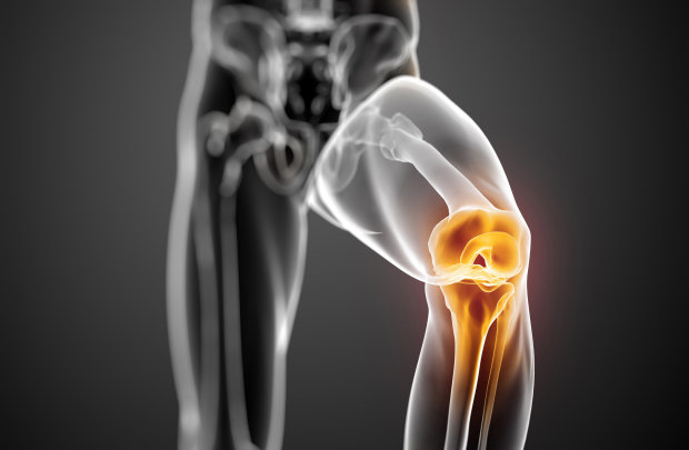 Атлас на коліна: імплант-амортизатор позбавить артрозу