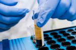Ворог мого ворога: дослідники нацькували вірус на рак