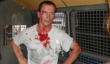 Катування Дадіна: прокуратура взялася за співробітників колонії