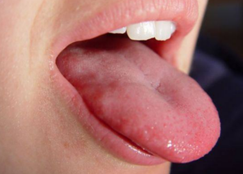 Язик, зображення з вільних джерел