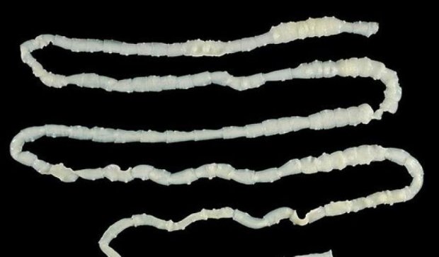 Врачи обнаружили внутри китайца шестиметрового червя