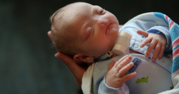 Малюк з чотирма почуттями: в Іраку народилася дитина без носа