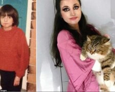 С таким диагнозом многие не доживают и до 5 лет, а она отметила 35: девушка имеет кожу бабочки и страдает каждый день