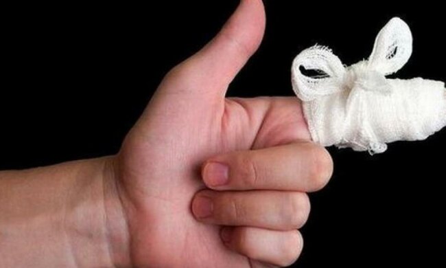 У Києві чоловік відкусив пальця сусіду