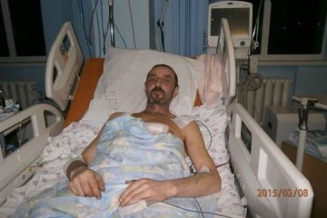 Черкаському бійцю АТО витягли осколок із серця