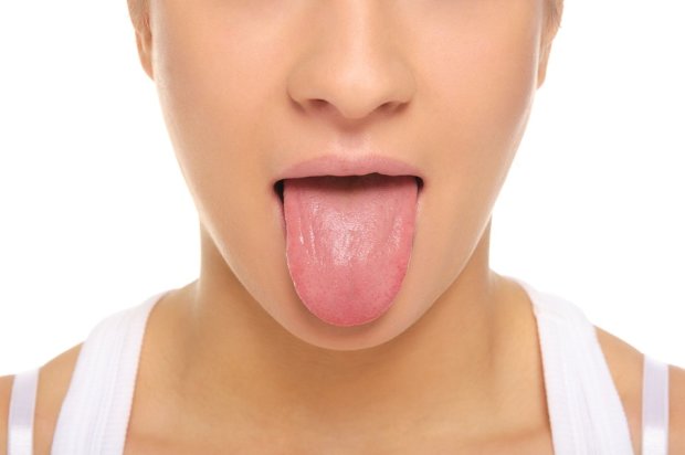 Що означає білий наліт на язику