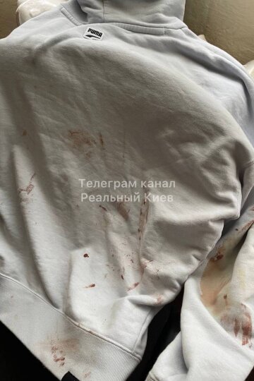 Аварія автобуса "Гюнсел" у Румунії, фото від пасажирів