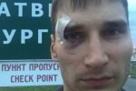 У Росії не побачили криміналу у побитті журналіста бойовиками «ДНР»