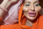 Перероблена Покрищук похизувалась своєю "силіконовою долиною": "Геморой замість губ"