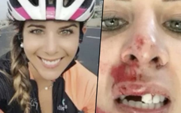 Під час стрибка з тарзанки дівчина втратила зуби: відео