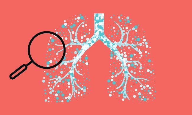 Бронхіт або пневмонія: як розпізнати небезпечні захворювання
