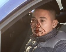 На валютників-в'єтнамців зі «Сьомого кілометра» напали в Одесі (фото, відео)