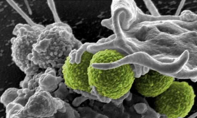 Миру угрожают бактерии, которых не убивают антибиотики