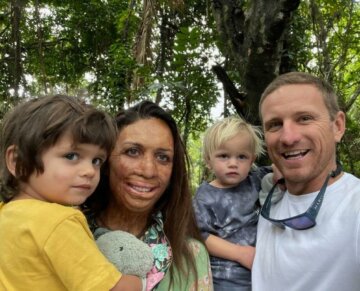 Instagram/Turia Pitt