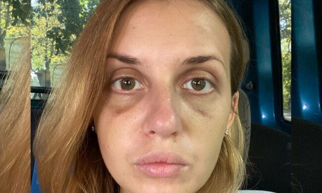 Чоловік, який напав на Настю Лугову в поїзді, помер в СІЗО, постраждала зробила заяву: "Страх пішов разом з ним"