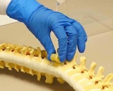 Американські вчені навчилися відновлювати спинний мозок