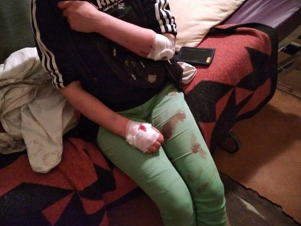 Дика жорстокість струсонула українських батьків: скалічили дитину заради задоволення - "нелюди"