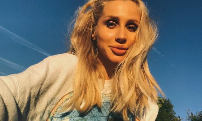 Лобода шокувала фанатів своїм обличчям, природа постаралася як слід