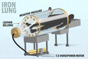 Залізні легені, фото: TheSun