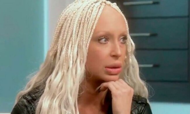 Американка изуродовала губы неудачной иньекцией "овечьего жира"