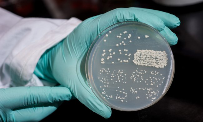 Новий вісник Апокаліпсису: смертельний супергрибок йде по світу, експерти розводять руками