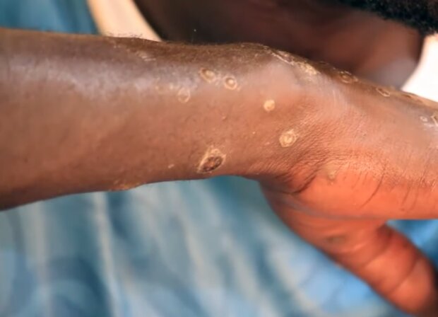 У Сенегалі стався спалах невідомої хвороби, фото: кадр з відео