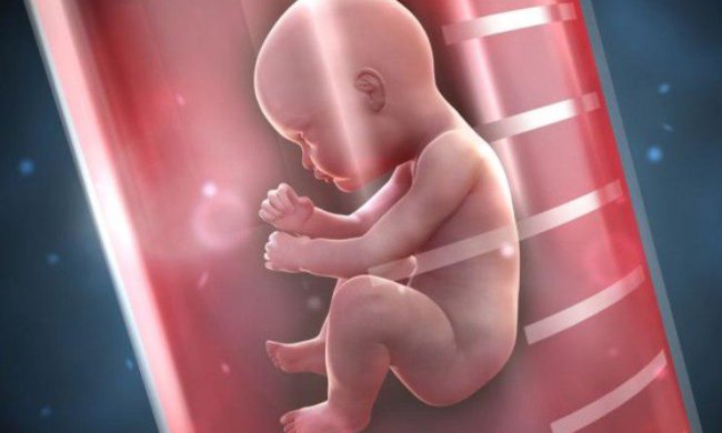 Как избежать детских генетических заболеваний