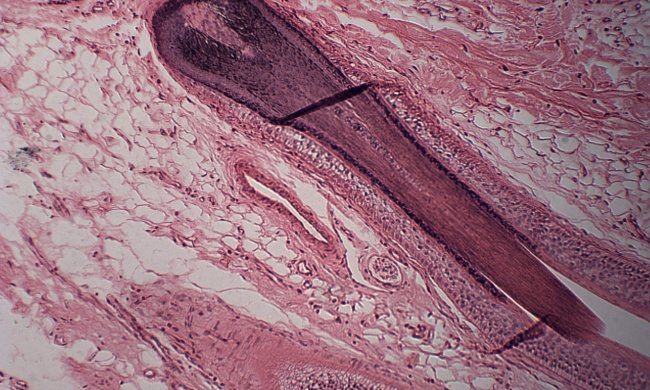 Вчені навчилися відновлювати волосся в пошкоджених місцях