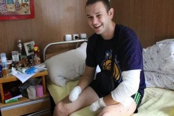 Боєць з ампутованими кистями рук став масажистом