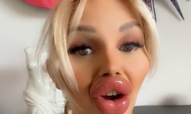 Обладательница самых крупных губ в Европе. Фото TikTok