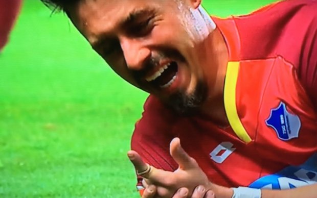 Ужасный перелом пальца футболиста немецкого клуба